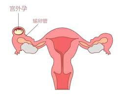 香港二代试管婴儿流程-关于香港男性和女性的血液检查，你应该知道什么!
