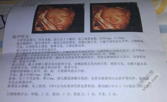 香港双胞胎二代试管婴儿机构:外国人用来测试男人和女人的方法--小苏打--是令人难以置信的准确!