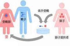 <b>香港50岁三代试管婴儿公司:如何预防怀孕期间的宫颈感染</b>