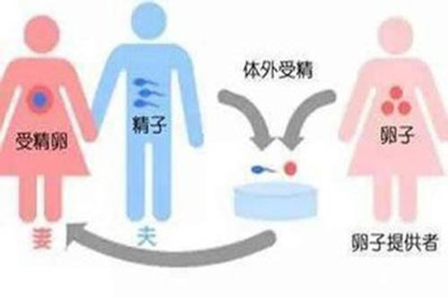 香港50岁三代试管婴儿公司:如何预防怀孕期间的宫颈感染